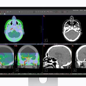 DICOM Medical Imaging - A Studio Display XDR monitor showcases six brain CT scan images from DICOM Medical Imaging, featuring both cross-sectional and lateral views with color overlays highlighting specific regions and blood vessels.
