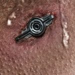 A close-up of human skin with a small, round, metallic object embedded in it, showing redness and irritation—a scene evocative of Neuromancer and the cyberpunk science fiction aesthetic.