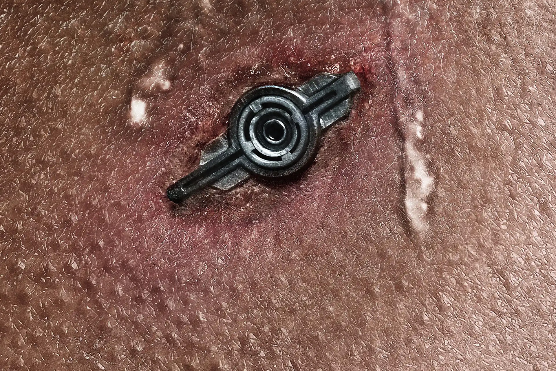 A close-up of human skin with a small, round, metallic object embedded in it, showing redness and irritation—a scene evocative of Neuromancer and the cyberpunk science fiction aesthetic.
